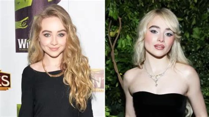 Unraveling The Mystery: Has Sabrina Had Plastic Surgery?